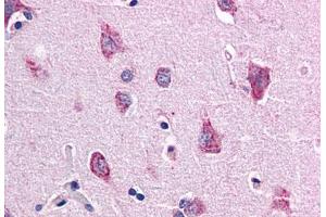 Anti-TM9SF4 antibody  ABIN1049416 IHC staining of human brain, cortex. (TM9SF4 antibody  (Internal Region))