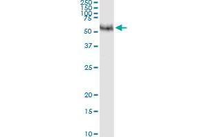 Immunoprecipitation of MMP8 transfected lysate using anti-MMP8 MaxPab rabbit polyclonal antibody and Protein A Magnetic Bead , and immunoblotted with MMP8 purified MaxPab mouse polyclonal antibody (B01P) . (MMP8 antibody  (AA 1-467))