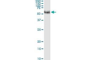 Immunoprecipitation of MMP8 transfected lysate using anti-MMP8 MaxPab rabbit polyclonal antibody and Protein A Magnetic Bead , and immunoblotted with MMP8 purified MaxPab mouse polyclonal antibody (B01P) . (MMP8 antibody  (AA 1-467))