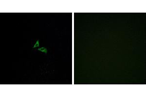 Peptide - +Western blot analysis of extracts from Jurkat cells, using EDG7 antibody. (LPAR3 antibody  (C-Term))