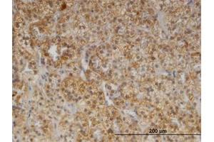 Image no. 1 for anti-Cerebellar Degeneration-Related Protein 2, 62kDa (CDR2) (AA 296-405) antibody (ABIN599360) (CDR2 antibody  (AA 296-405))