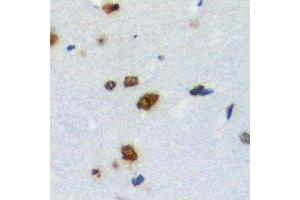 Immunohistochemical analysis of ZNF668 staining in human brain formalin fixed paraffin embedded tissue section. (ZNF668 antibody)