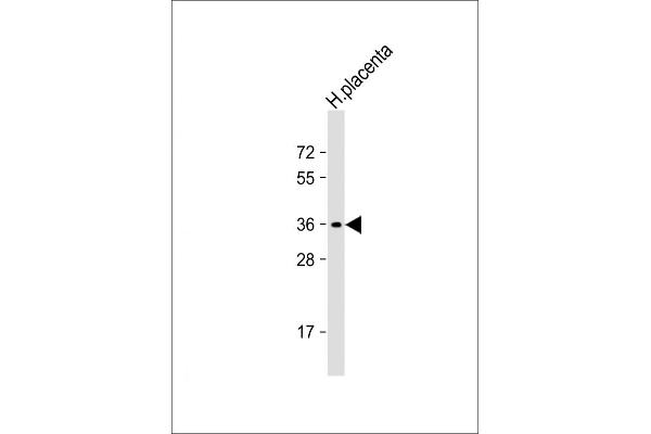 OR8A1 anticorps  (N-Term)