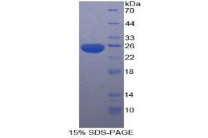 SDS-PAGE (SDS) image for Stromal Cell Derived Factor 4 (SDF4) (AA 184-382) protein (His tag) (ABIN1879421)
