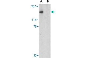 Western blot analysis of SLITRK5 in NIH/3T3 cell lysate with SLITRK5 polyclonal antibody  at 1 ug/mL in the (A) absence or (B) presence of blocking peptide. (SLITRK5 antibody  (Internal Region))