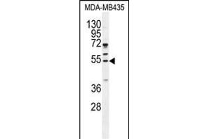 CCNB1 Antibody (Center) (ABIN655048 and ABIN2844676) western blot analysis in MDA-M cell line lysates (35 μg/lane). (Cyclin B1 antibody  (AA 241-268))