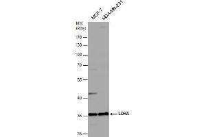 WB Image Various whole cell extracts (30 μg) were separated by 10% SDS-PAGE, and the membrane was blotted with LDHA antibody , diluted at 1:1000.
