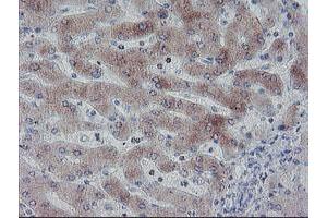 Immunohistochemical staining of paraffin-embedded Human liver tissue using anti-C20orf3 mouse monoclonal antibody. (APMAP antibody)