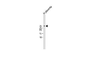 All lanes : Anti-CGB/HCG-Beta Antibody (C-term)at 1:1000 dilution Lane 1:Human placenta lysate Lysates/proteins at 20 μg per lane. (CGB antibody  (C-Term))