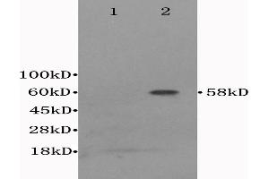 L1 Mouse cerebrum lysates, L2 mouse liver lysates probed with Anti- CD122/IL-2RB Polyclonal Antibody, Unconjugated (ABIN675923) at 1:300 in 4 °C.