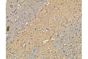 ABIN6264733 and ABIN6279767 at 1/100 staining rat brain tissue by IHC-P.