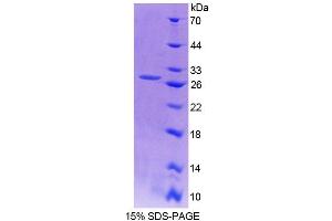 SDS-PAGE analysis of Mouse AFAP1 Protein. (AFAP Protein)