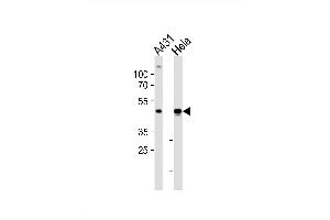 Western blot analysis of lysates from A431, Hela cell line (from left to right), using NOVA1 Antibody (Center) (ABIN6243271 and ABIN6577731). (NOVA1 antibody  (AA 139-173))