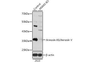 Western Blotting (WB) image for anti-Annexin A5 (ANXA5) (AA 1-320) antibody (ABIN3022451)