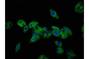 Immunofluorescence staining of HepG2 cells with ABIN7149771 at 1:133, counter-stained with DAPI. (Desmocollin 3 antibody  (AA 712-896))