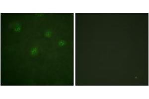 Immunofluorescence analysis of A549 cells, using Estrogen Receptor-alpha (Ab-537) Antibody.