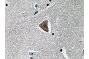Immunohistochemistry analyzes of Rock-1 antibody in paraffin-embedded human brain tissue. (ROCK1 antibody)
