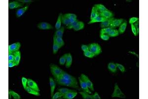 Immunofluorescence staining of HepG2 cells with ABIN7163597 at 1:100, counter-stained with DAPI. (PAFAH2 antibody  (AA 1-206))
