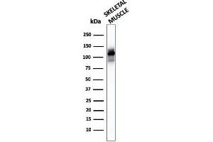 Western Blot of human skeletal muscle tissue lysates using Sarcomeric Actinin Alpha 2 Mouse Monoclonal Antibody (ACTN2/3293). (ACTN2 antibody  (AA 557-692))