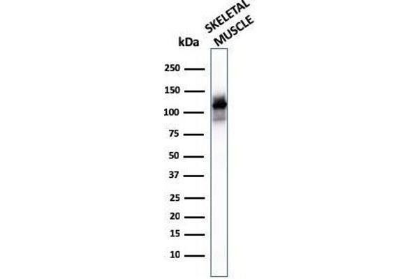 ACTN2 antibody  (AA 557-692)