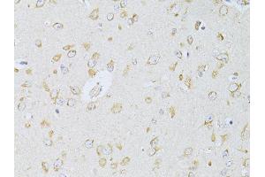 Immunohistochemistry of paraffin-embedded rat brain using NTS antibody (ABIN5998396) at dilution of 1/100 (40x lens). (Neurotensin antibody)