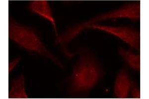 Image no. 3 for anti-Nuclear Factor-kB p65 (NFkBP65) (pSer529) antibody (ABIN196955) (NF-kB p65 antibody  (pSer529))