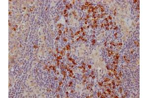 IHC image of ABIN7127437 diluted at 1:100 and staining in paraffin-embedded human lymph node tissue performed on a Leica BondTM system. (Recombinant CTLA4 antibody)