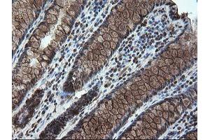Image no. 1 for anti-serine/threonine Kinase 38 Like (STK38L) (AA 1-281) antibody (ABIN1490699) (STK38L antibody  (AA 1-281))