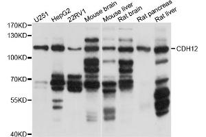 Western blot analysis of extracts of various cell lines, using CDH12 antibody (ABIN5997412) at 1/1000 dilution. (Cadherin 12 antibody)
