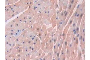 DAB staining on IHC-P;;Samples: Mouse Heart Tissue (FABP3 antibody  (AA 1-133))