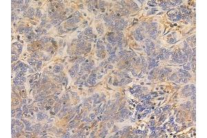 ABIN6260112 and ABIN6277506 at 1/100 staining human thymoma by IHC-P. (ATL1 antibody  (N-Term))