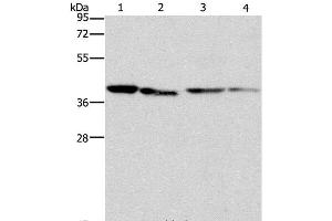 Western Blot analysis of Human placenta tissue and NIH/3T3 cell, Raji and hepG2 cell using BCAT2 Polyclonal Antibody at dilution of 1:312.