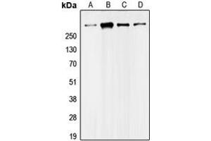 Western blot analysis of UBR5 expression in Jurkat (A), HeLa (B), MDAMB468 (C), NIH3T3 (D) whole cell lysates. (UBR5 antibody  (N-Term))