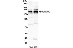 Western Blotting (WB) image for anti-AT Rich Interactive Domain 4A (RBP1-Like) (ARID4A) (AA 900-950) antibody (ABIN7451641)
