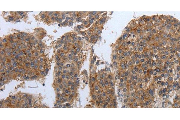 PDIA2 antibody