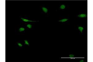 Immunofluorescence of monoclonal antibody to EIF1AY on HeLa cell. (EIF1AY antibody  (AA 22-95))