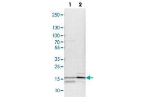Western blot analysis of lane 1: NIH-3T3 and lane 2: NBT-II cell lysates using FABP4 polyclonal antibody . (FABP4 antibody)