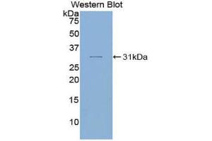 Western Blotting (WB) image for anti-SMAD, Mothers Against DPP Homolog 6 (SMAD6) (AA 116-364) antibody (ABIN1860594) (SMAD6 antibody  (AA 116-364))