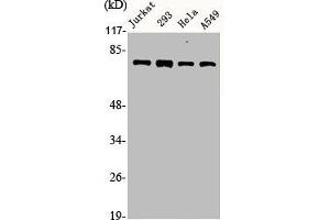 Western Blot analysis of Jurkat 293 HELA A549 cells using Actinin-α1/2/3/4 Polyclonal Antibody (ACTN1/ACTN2/ACTN3/ACTN4 (N-Term) antibody)