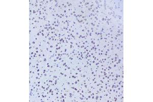 IHC analysis of TPR using anti-TPR antibody (ABIN5693275). (TPR antibody)