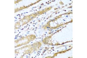 Immunohistochemistry of paraffin-embedded human stomach using UBE2L3 antibody (ABIN5972307) at dilution of 1/100 (40x lens). (UBE2L3 antibody)