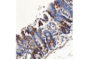 IHC analysis of SH2D4A using anti-SH2D4A antibody (ABIN7601695). (SH2D4A antibody  (AA 42-454))