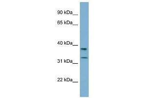 RALGPS2 antibody used at 1 ug/ml to detect target protein. (RALGPS2 antibody  (N-Term))