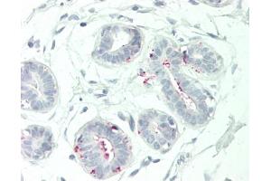 Immunohistochemistry (Paraffin-embedded Sections) (IHC (p)) image for anti-Natural Killer Cell Cytotoxicity Receptor 3 Ligand 1 (NCR3LG1) (AA 389-415) antibody (ABIN2743178)