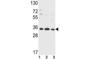 Western blot analysis of Annexin V antibody and (1) HepG2, (2) A2058, (3) T47D lysate.