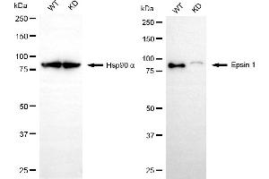 Western blotting analysis using epsin 1 antibody (ABIN7798486). (Recombinant Epsin 1 antibody)