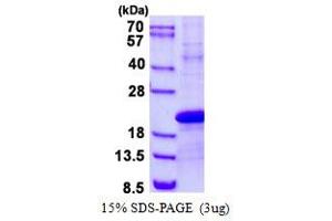 PDZ Domain Containing 11 (PDZD11) (AA 1-140) protein (His tag)