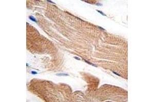 IHC analysis of FFPE human skeletal muscle tissue stained with ILK1 antibody (ILK antibody  (AA 151-180))