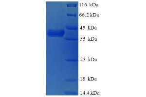 SDS-PAGE (SDS) image for DnaJ (Hsp40) Homolog, Subfamily B, Member 8 (DNAJB8) (AA 1-232), (full length) protein (His-SUMO Tag) (ABIN5711573)