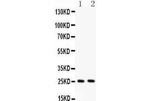 Anti- TNF alpha Picoband antibody, Western blotting All lanes: Anti TNF alpha  at 0. (TNF alpha antibody  (AA 80-227))